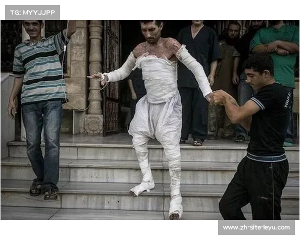 南非残疾泳将起诉航空公司因暴力托运致比赛用轮椅严重损坏